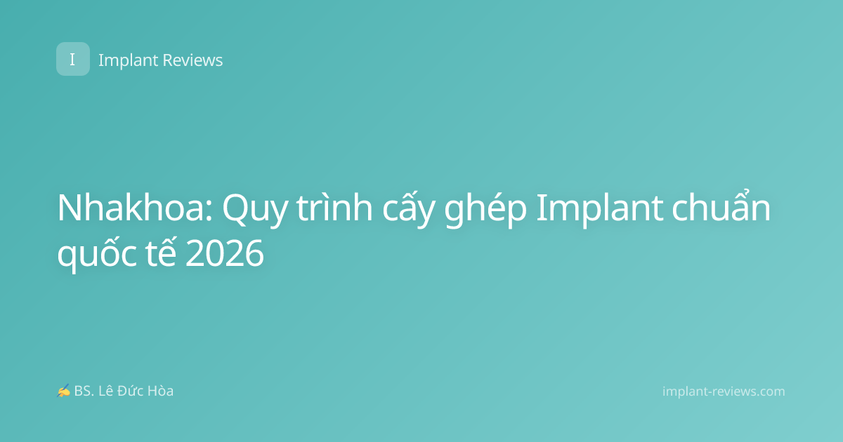 Nhakhoa: Quy trình cấy ghép Implant chuẩn quốc tế 2026
